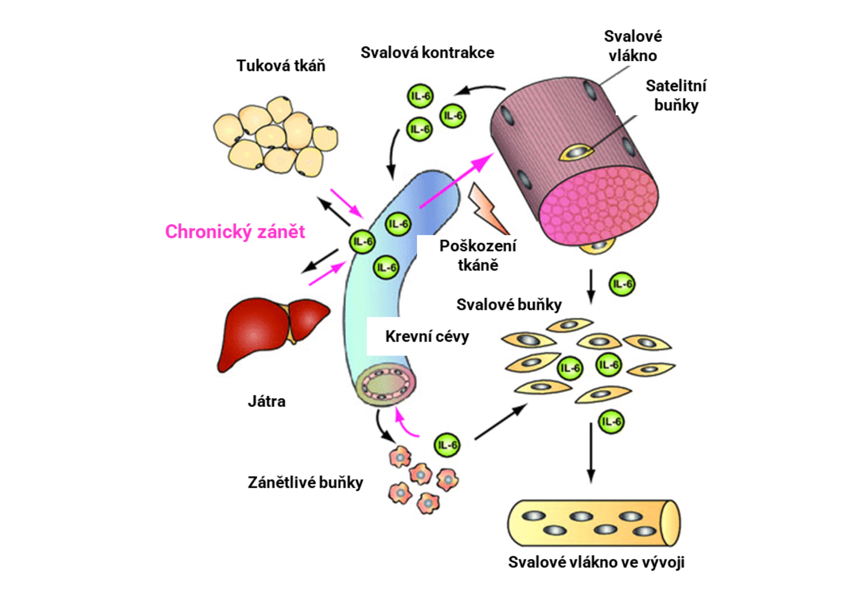 Působení IL6 v těle sportovce