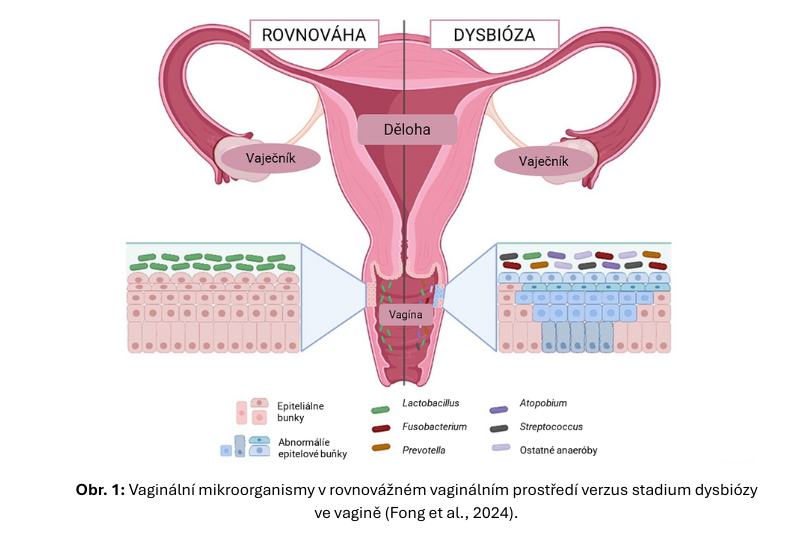 Infografika zobrazující rozdíl v bakteriálním složení vaginálního mikrobiomu u žen ve stavu rovnováhy a dysbiózy